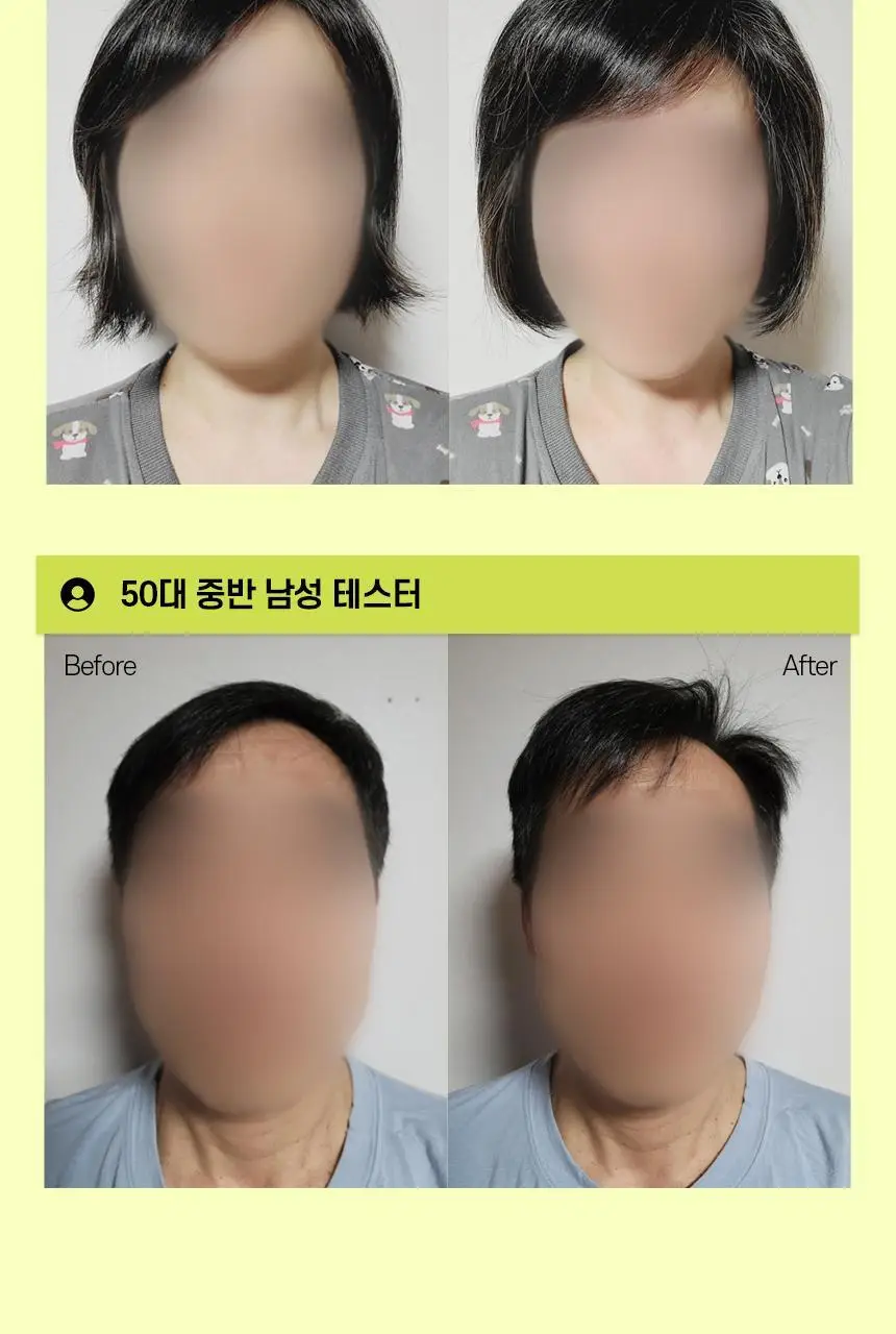 [카이스트특허기술] 그래비티 헤어리프팅 샴푸 엑스트라 스트롱 475ml 상세페이지 20